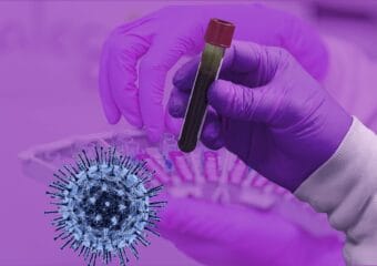 कोरोनाको भ्याक्सिन तयार हुन अझै १८ महिना लाग्न सक्छ : डब्ल्युएचओ