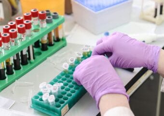 आरडीटि होइन पिपिआर प्रबिधिबाट मात्र परिक्षण गराऊँ: राष्ट्रिय मानव अधिकार आयोग